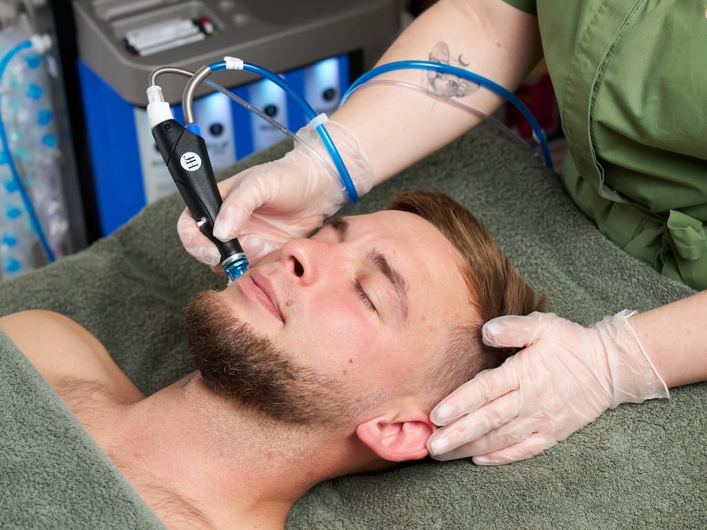 men on sessions of HydraFacial