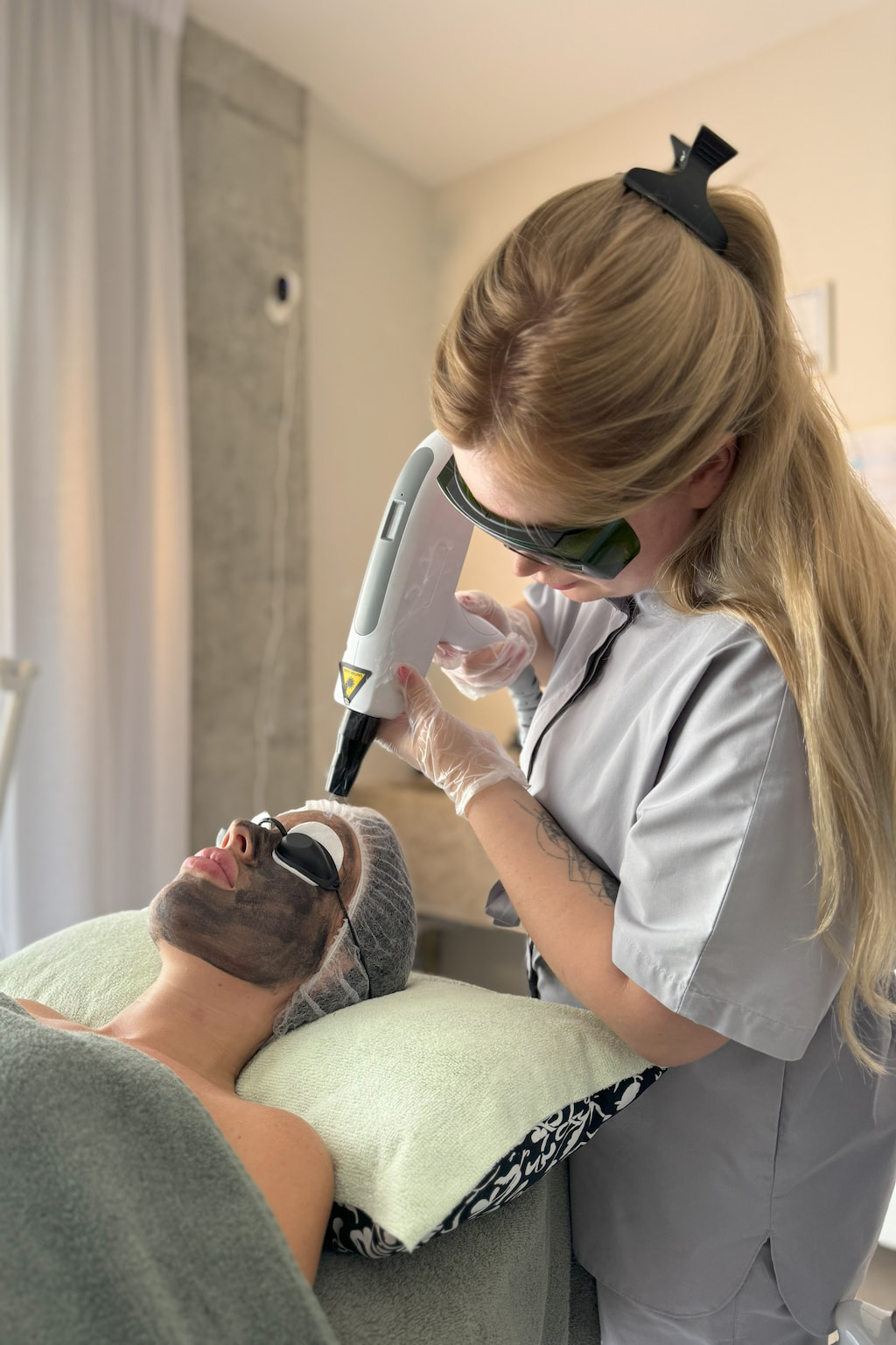 carbon peeling spesialist